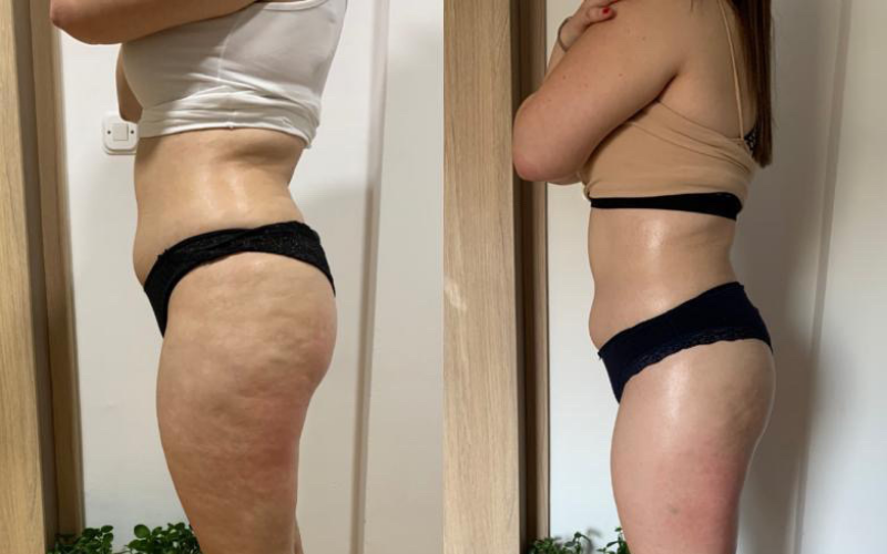 before-after
