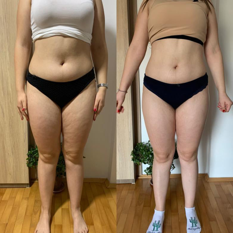 before-after