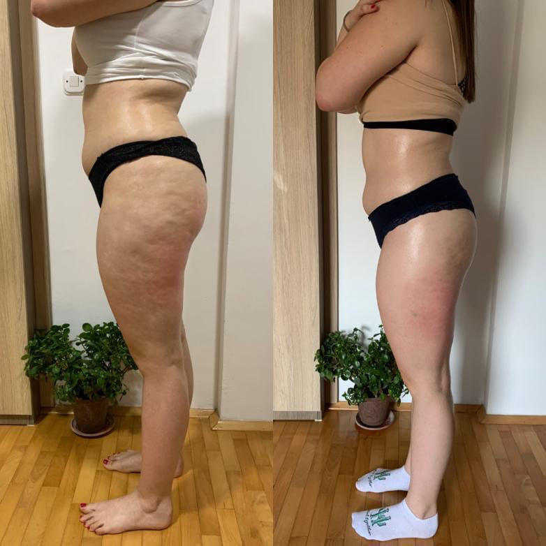 before-after
