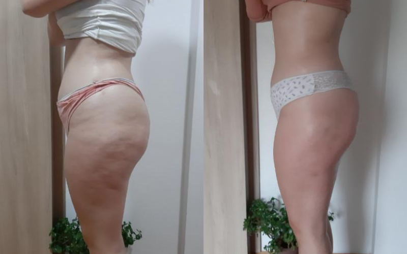 before-after