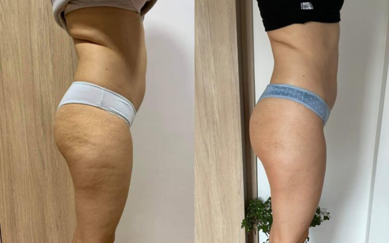 before-after