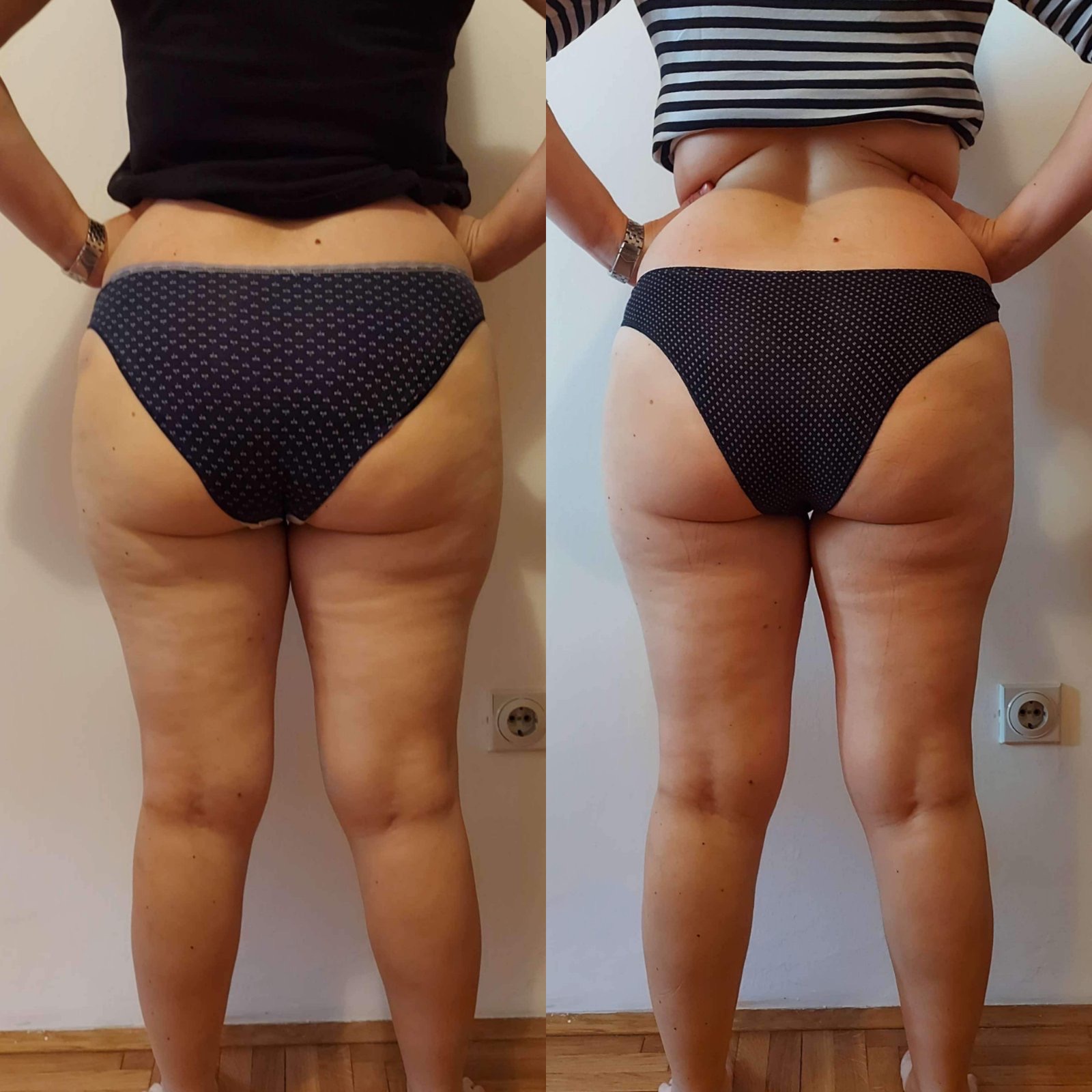 before-after